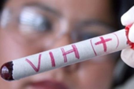 Científicos dicen haber encontrado “cura funcional” para el VIH