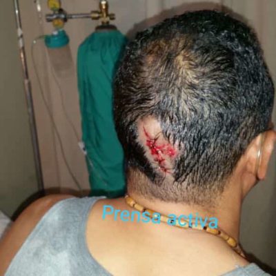 Hombre que aparece en vídeo al propinarle pedrada resulta herido en la cabeza