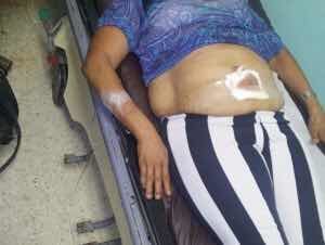 Estable la mujer herida por ‘’bala perdida’’ en Navarrete