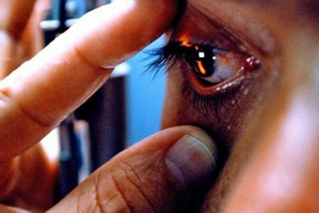 Los ojos, una ventana para detectar enfermedades